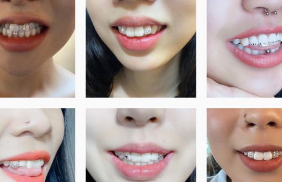 Zahn-Juwelen: der letzte Schrei in Korea